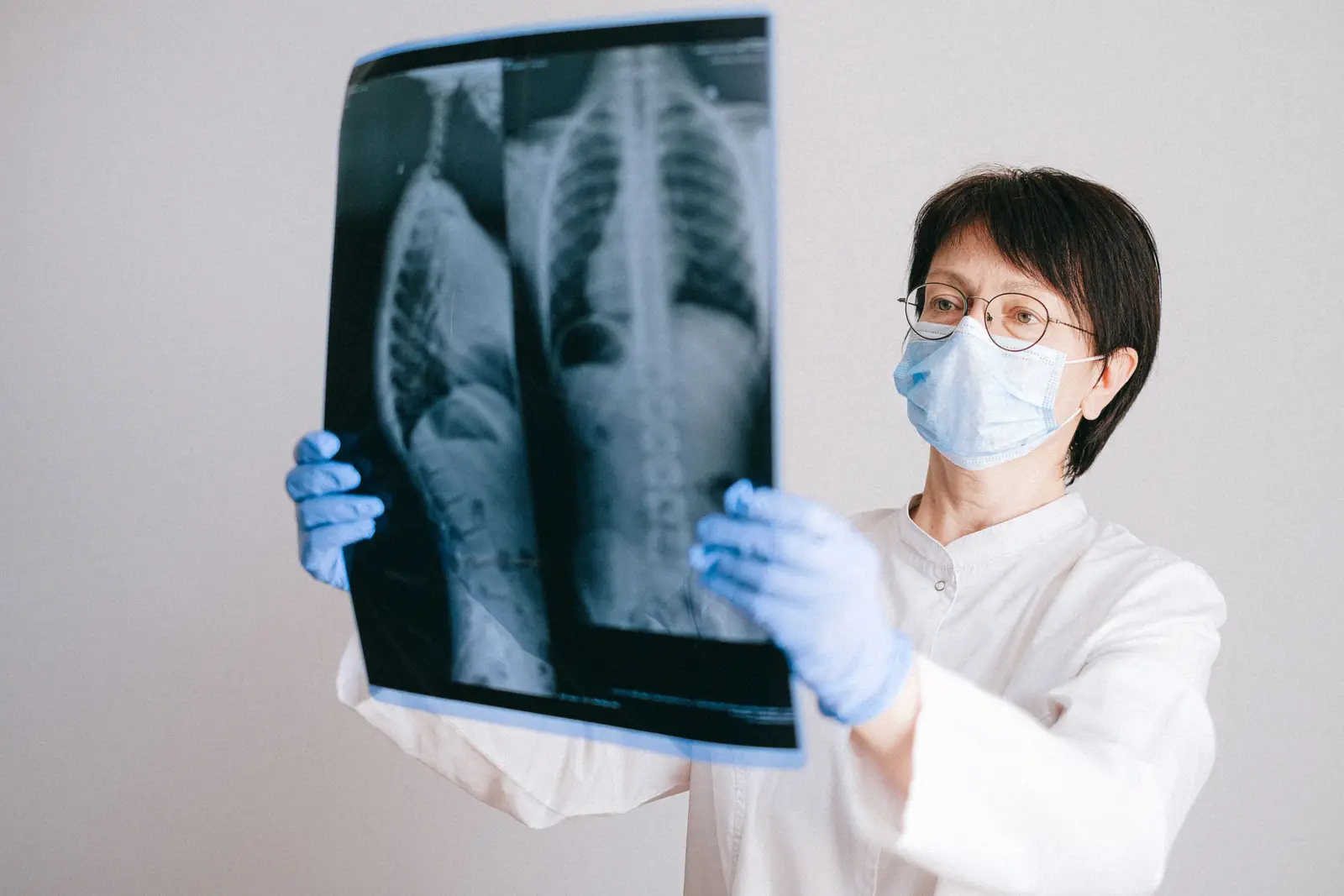 Radiólogo mirando una radiografía a contraluz